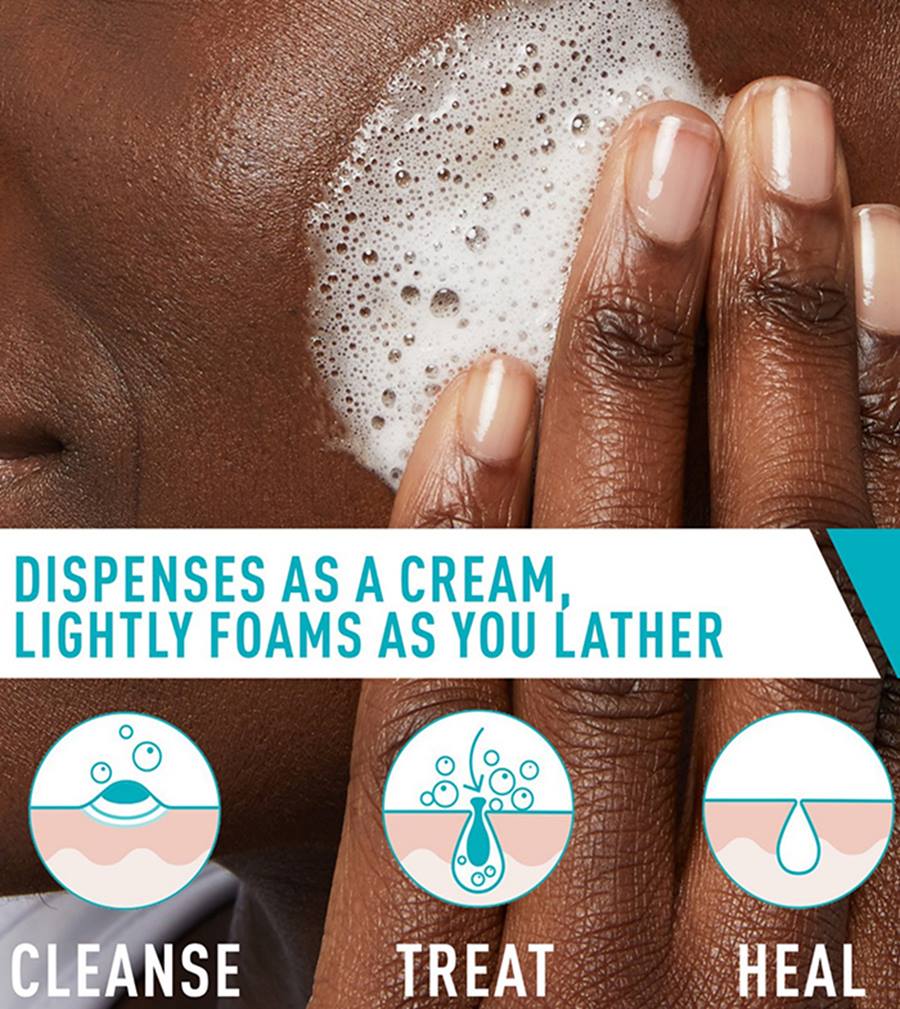 Cerave Acne Foaming Cream Cleanser 150 ml